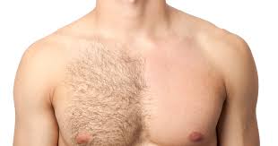 Erkekler İçin Fazla Vücut Tüylerini Alma Rehberi